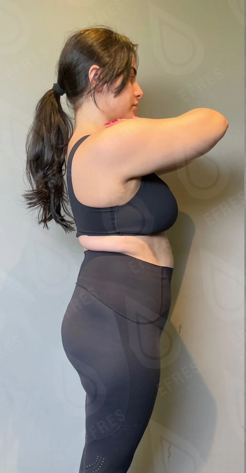 Похудение до-после5