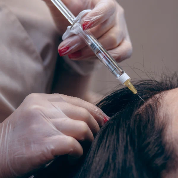 Мезотерапия кожи головы